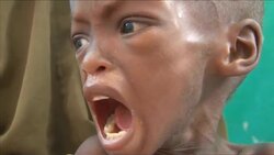 Thousands of Somalis face starvation as British PM hosts hunger summit News Clip