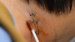 bathe the suture by himself Stock Footage