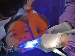 Little Girl At Dentist. Stock Footage