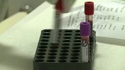 VOICED: Abidjan AIDS clinic treats patients for flat annual fee News Clip