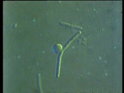 CU microscopic time lapse view of antibiotic Penicillin works against Lysis bacteria by attacking the cell walls Stock Footage