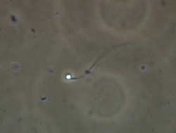 Single Human sperm swimming, Phase contrast Stock Footage