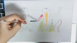 close up TL : paint teeth draft on laptop Stock Footage