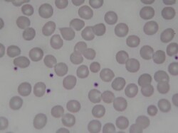 Human Red blood cells Stock Footage
