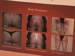 VOICED: Plastic surgery is Beirut's latest attraction News Clip