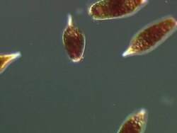 Euglenoids differential interference contrast Stock Footage