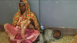 Cholera epidemic is killing children weakened by malnutrition News Clip
