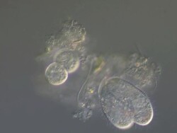 Ciliates feeding, close up Stock Footage