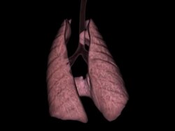 CAT Scan of Dog's Lung Stock Footage