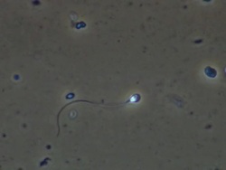 Human sperm, single sperm swimming strongly across frame Stock Footage