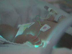 More premature babies are surviving being born early. News Clip