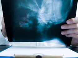 Doctor holding x-ray Stock Footage