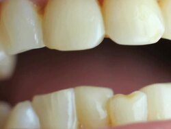 Human teeth Stock Footage