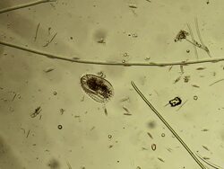 Microorganism: euplote Stock Footage