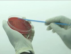 Scientists Working in Malaria Research Laboratory News Clip