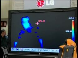 Authorities prepare strategy for second wave of swine flu News Clip