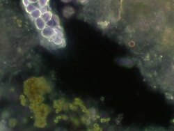 Ciliate unidentified Stock Footage