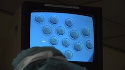 New federal statistics show an epidemic of twins among IVF patients, and two babies come with added risk during pregnancy. Reproduction experts are now urging more women in fertility treatment to try it one embryo at a time. (Dec. 2) News Clip