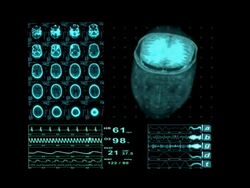 Medical MRI Neurological XRay Scan Brain Stock Footage