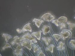 Vorticella protozoa feeding. Stock Footage