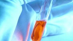 Pouring yellow liquid into Beaker Stock Footage