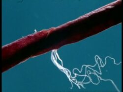 Jellyfish wrapped around spine of Sea Urchin, puts out tentacles in blue water, Australia Stock Footage