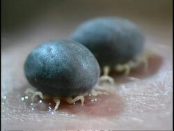 Parasite/Vector - African Ticks (Ornithodorus moubata), 2 ticks on human skin Stock Footage