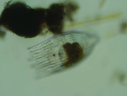 Microbe in dirty water Stock Footage