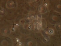 Human sperm, lots swimming around, red brown background Stock Footage