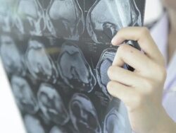 Doctor reading MRI film result Stock Footage