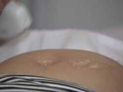 Midwife Looking At Ultrasound Scan On Screen News Clip