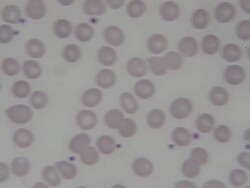 Human Red blood cells Stock Footage
