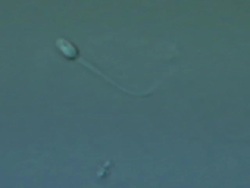 Single Human sperm swimming, big close up, Interference contrast Stock Footage