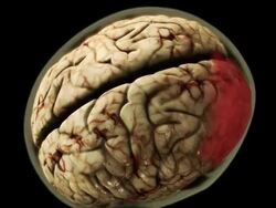 High Angle push-out - A computer-generated model of a human brain turns red. Stock Footage