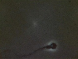 Microscopic footage of swimming sperm Stock Footage