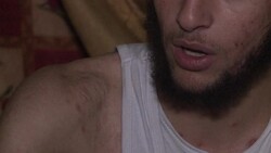 CLEAN: Braving death, Syria's wounded make their way to Lebanon News Clip