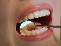 CU PAN Dentist examining woman's teeth with dental mirror during examination / Berlin, Germany Stock Footage