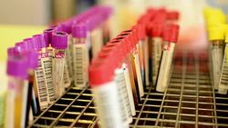 blood test Stock Footage