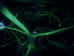 Extreme Close Up hand-held push-in - Parasitic worms pass between nerve tissue in a computer-generated animation. Stock Footage