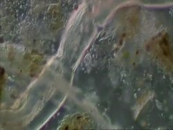 Planarian worm swimming gracefully Stock Footage