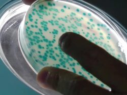 Blue bacteriophage plaques Stock Footage