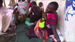 ++ONLY ON AP++ ++GRAPHIC++ Communities displaced, severley malnourished children after violence News Clip