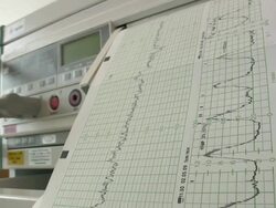 Fetal monitor  'EFM or CTG ' Stock Footage