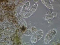 Ciliate Protozoa, Euplotes sp and Paramecium sp, recorded using Phase Contrast illumination. Stock Footage