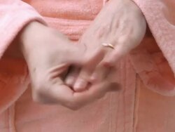 Woman Hands in  Arthritis Pain Stock Footage