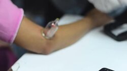 doctor treatment Stock Footage