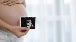Pregnant women, the film holds up ultrasound. Stock Footage