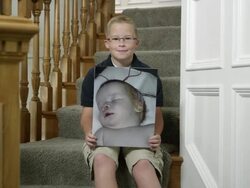 Child holding picture of himself as an infant with a birth defect Stock Footage