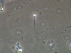Single Human sperm swimming, Phase contrast Stock Footage