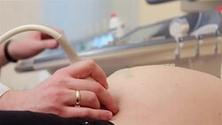 Ultrasonography Stock Footage